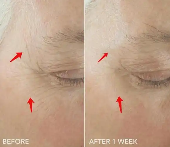 她,才是真不怕被封s