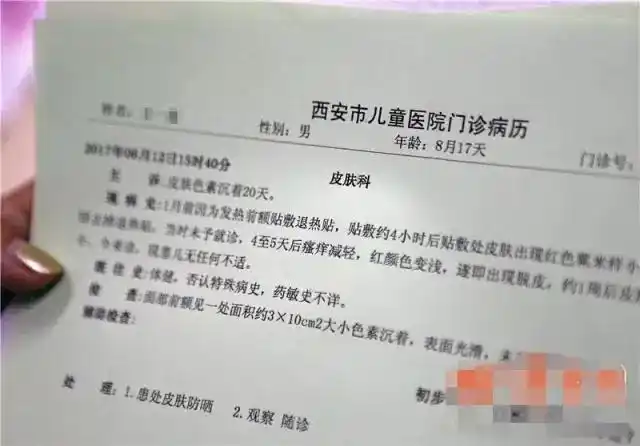 有儿童用后额头留黑印褪不掉