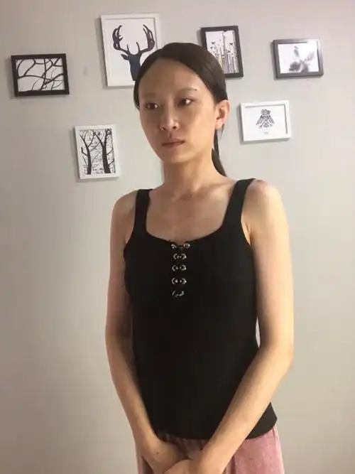 从高中开始就被朋友同学开玩笑说胸小,说发育不良,刚_圈子-新氧美容