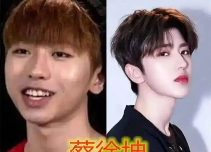8位"改头换命"的男明星,王一博脸已僵硬,刘恺威眼皮才是灵魂