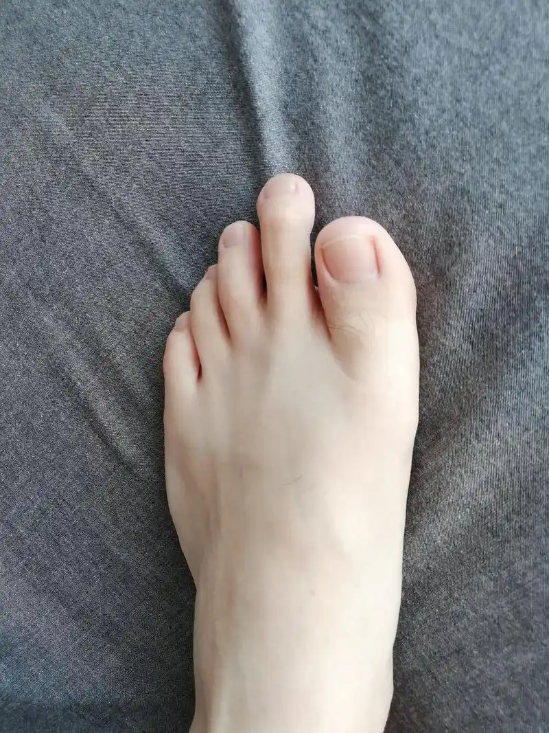 脚长这样凡是看到我脚的人都说我命苦,何意?