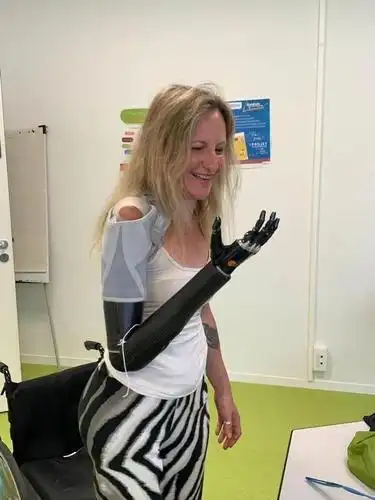 于是她第二天就要求医院给安装假肢,开启新生活.