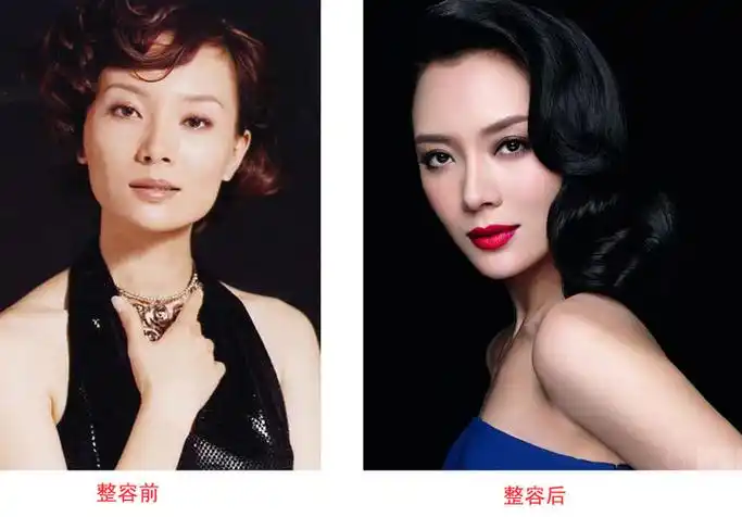 陈数 整容前后照片演员陈数整容