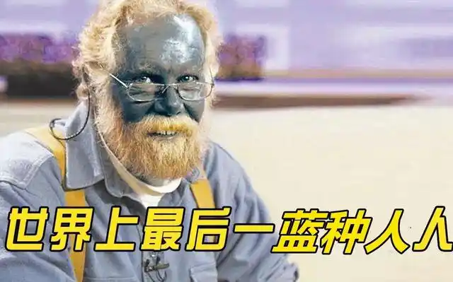 世界上绿种人,人口仅剩3000,不用吃饭靠晒太阳就能存活?