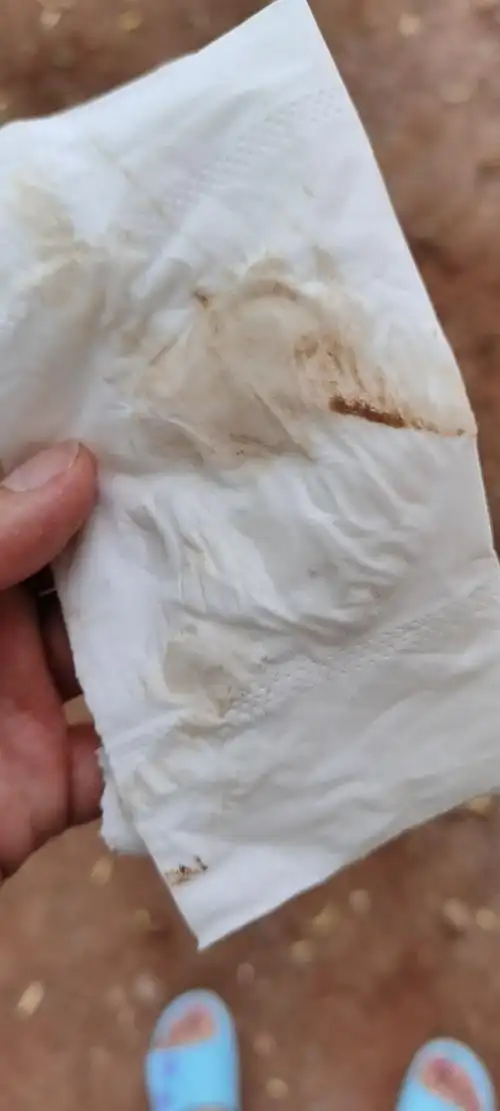 [试管婴儿]现在怀孕5周 2每天都有褐色分