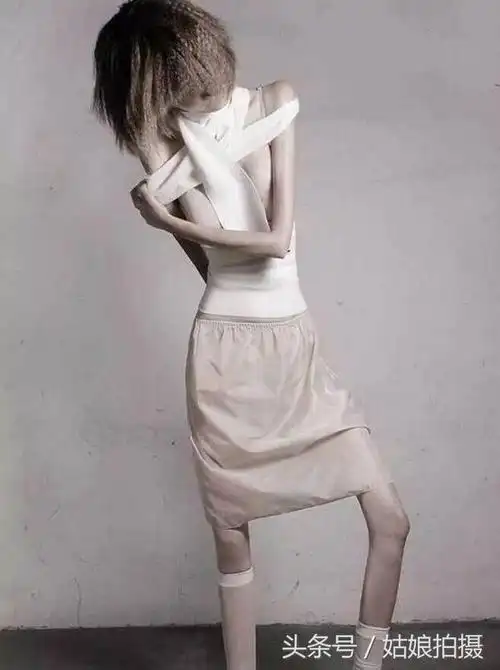 仅有32公斤,已经瘦成枯骨的女孩,仍拒绝吃饭