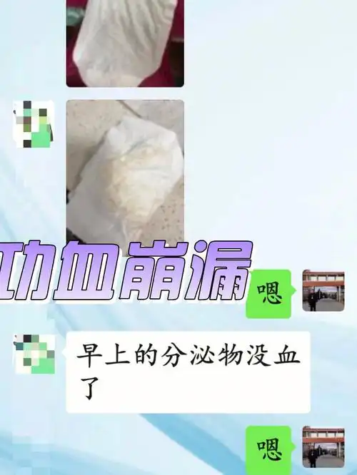 不孕,内膜厚,排卵期出血(四)