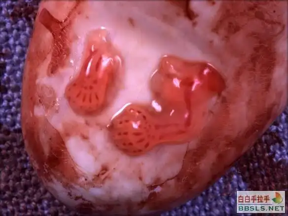 通常在这种胎儿先天有疾病的情况下,父母都会选择流产,但samuel