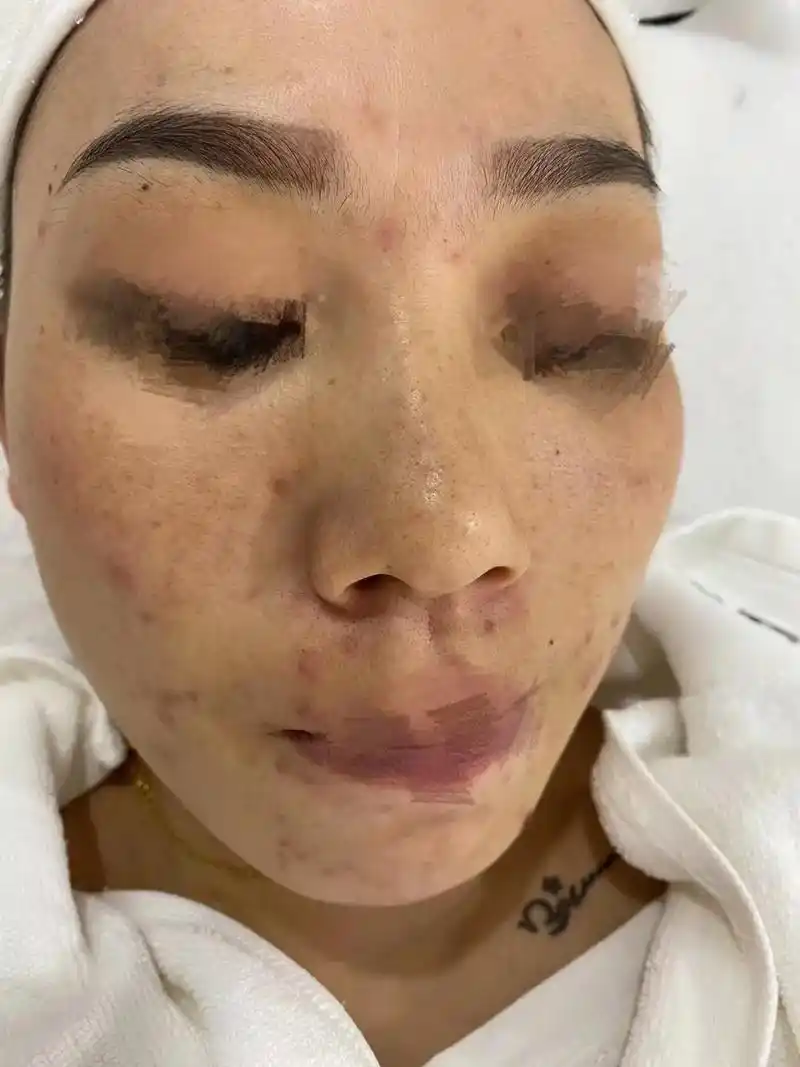 问题性皮肤管理 #原相机 - 抖音