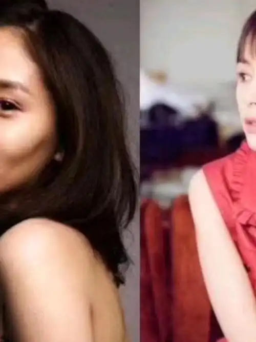 恰到好处的脂肪填充,王子文做的太绝了