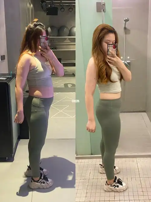 激素性肥胖瘦10斤前后对比