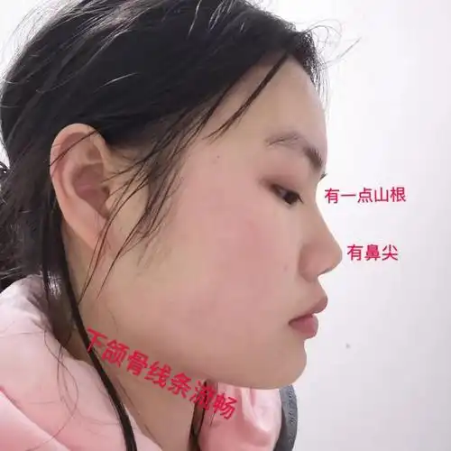 鼻子塌的人怎样使鼻梁变高让你拥有高挺迪丽热巴一样鼻子