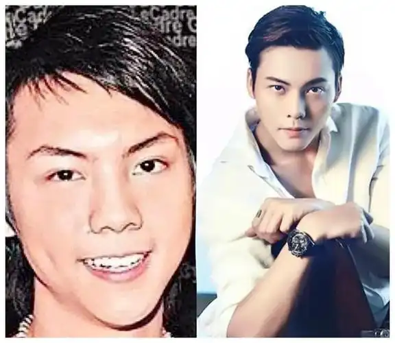 3位整容还拒不承认的明星:陈伟霆上榜,第1无争议