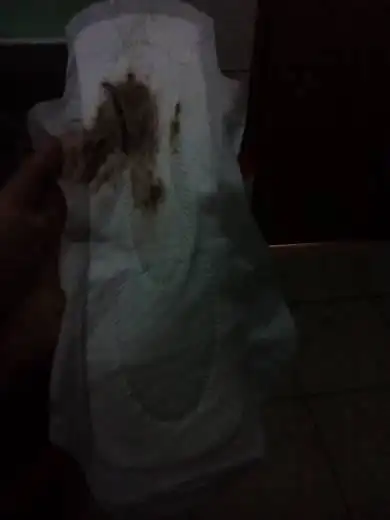 问:怀孕36天为什么先出六七滴答血,再出这玩意