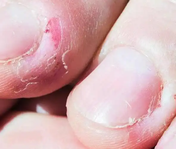 爱咬指甲的孩子,都逃不过这5种结局!