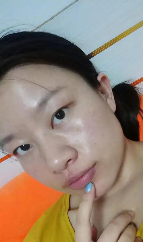 素颜状态(这做作的动作)眼下三角区凹陷还有法令纹凹陷