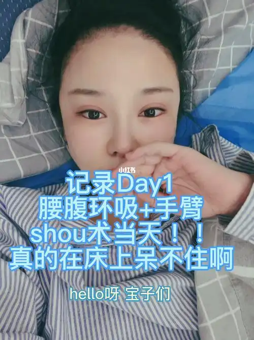 腰腹环吸shu后分享