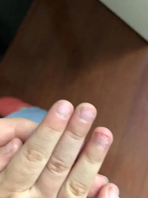 求助大家,孩子老是咬指甲怎么办?