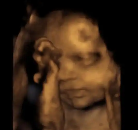 孕妇做四维彩超时为啥宝宝总是捂着脸3个原因很常见