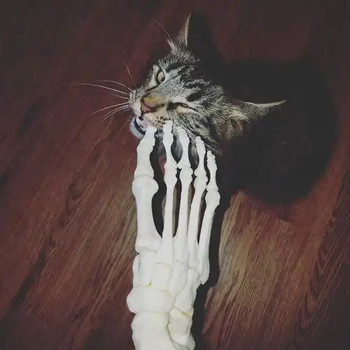 因癌症被截肢后 她和截掉的断脚成了自拍小伙伴