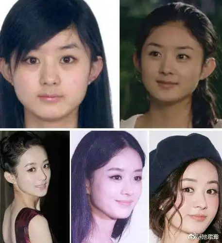 赵丽颖原本就是圆脸,随着年龄的增长,褪去了当年的婴儿肥,看起来多了