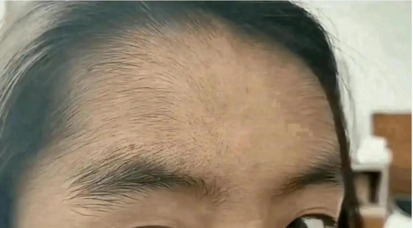 虽然发际线很低,但该秃还是得秃. #中国版chatgpt来了# #娱乐最前沿