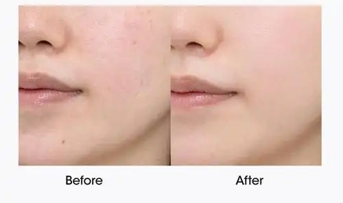 对比使用前后的差别,真的挺让人很惊喜.