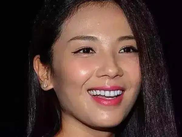 一颗瓷贴面牙齿多少钱明星假牙大pk