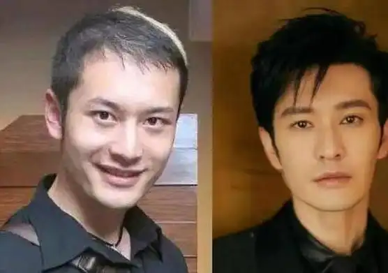 黄晓明的发际线之谜:节目里头套穿帮,假发还是植发更合适?