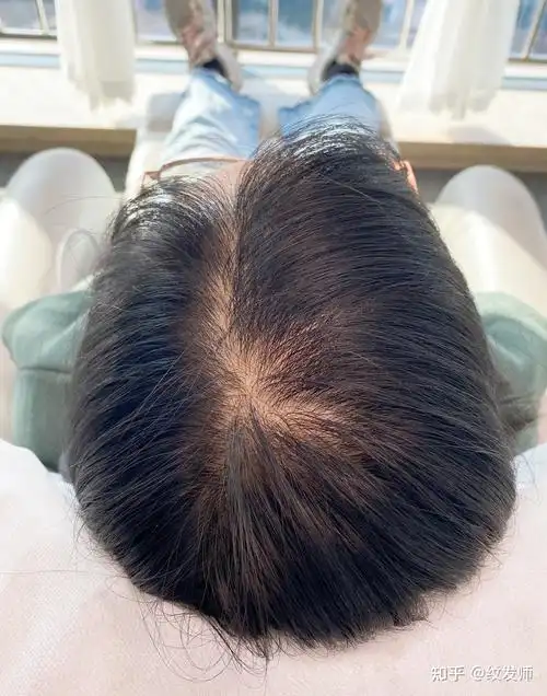 女生发质细软头发稀疏,做纹发效果好吗?