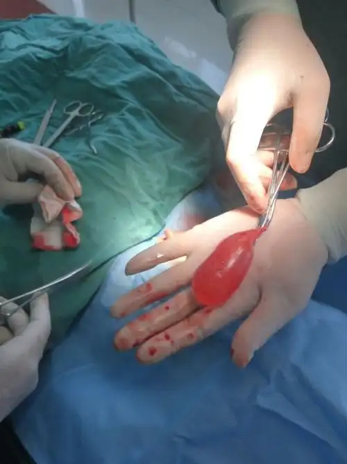 孩子的"蛋蛋"一下子就减轻了许多