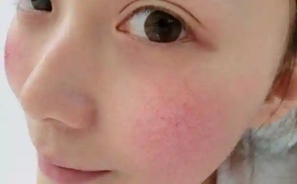 敏感皮肤一天洗几次脸?敏感皮肤怎么洗脸?-中名网