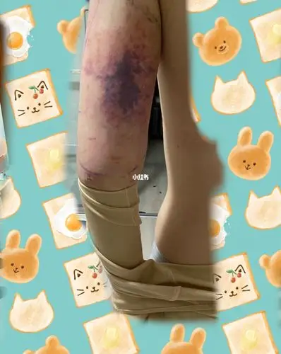 担心得睡不着_减肥_抽脂减肥_减肥_减肥医药