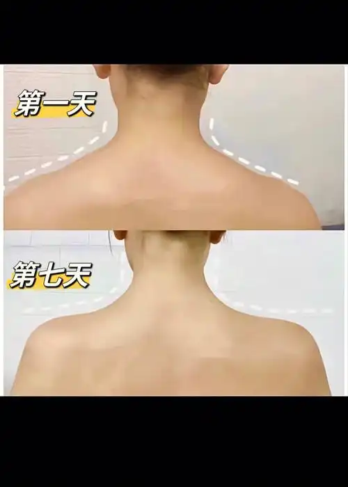 一个动作消除斜方肌直角肩养成73