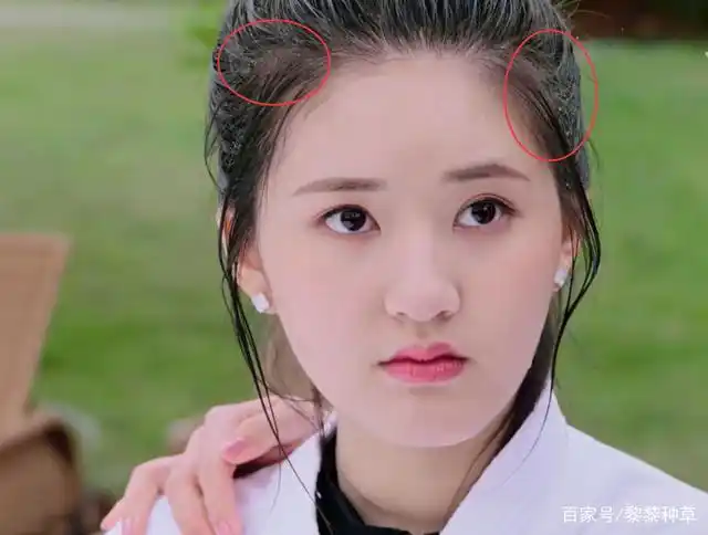 逆天发量 超标头皮屑?求赵露思你好好洗个头吧!