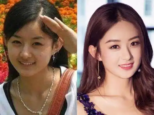 出道时的赵丽颖太土气?现在的她让你知道什么是女大十八变