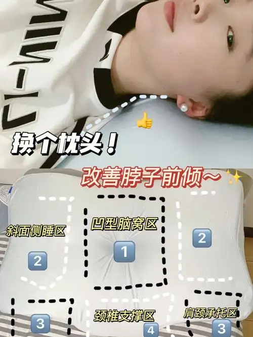 脖子前倾要不换个枕头试试