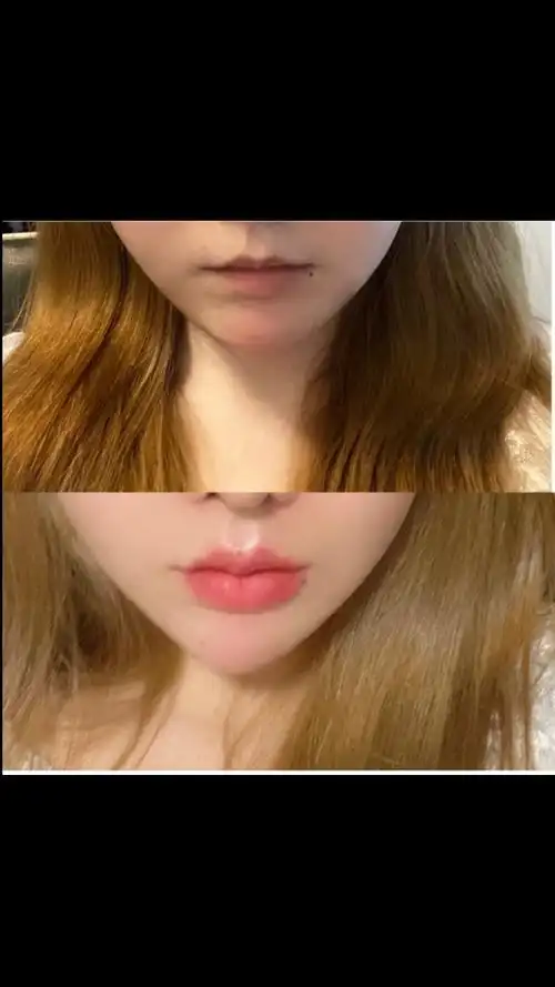 不一样的人生#嘟嘟唇前后对比