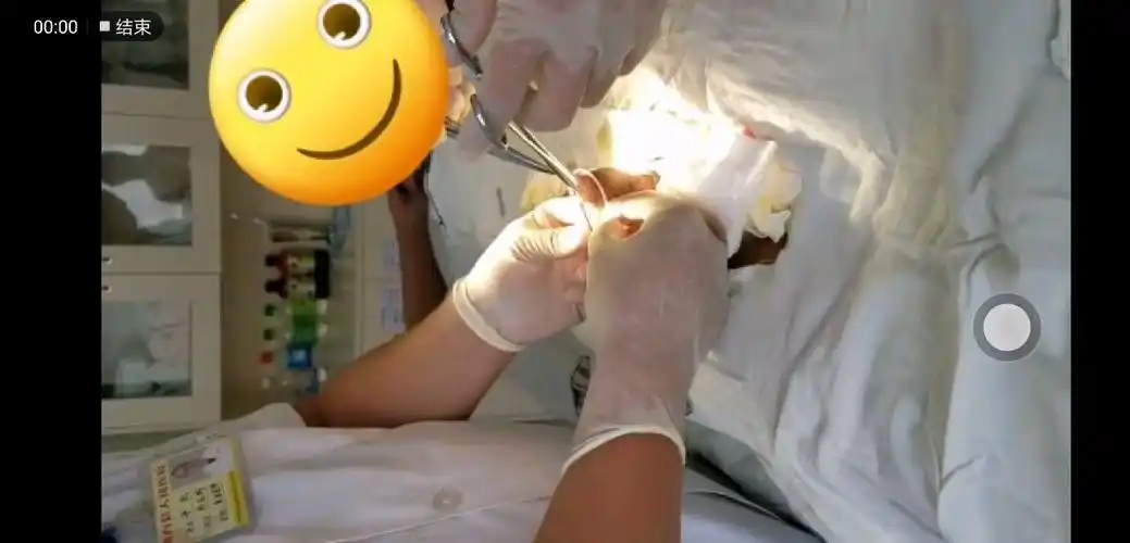 包皮环切术 - 好大夫在线