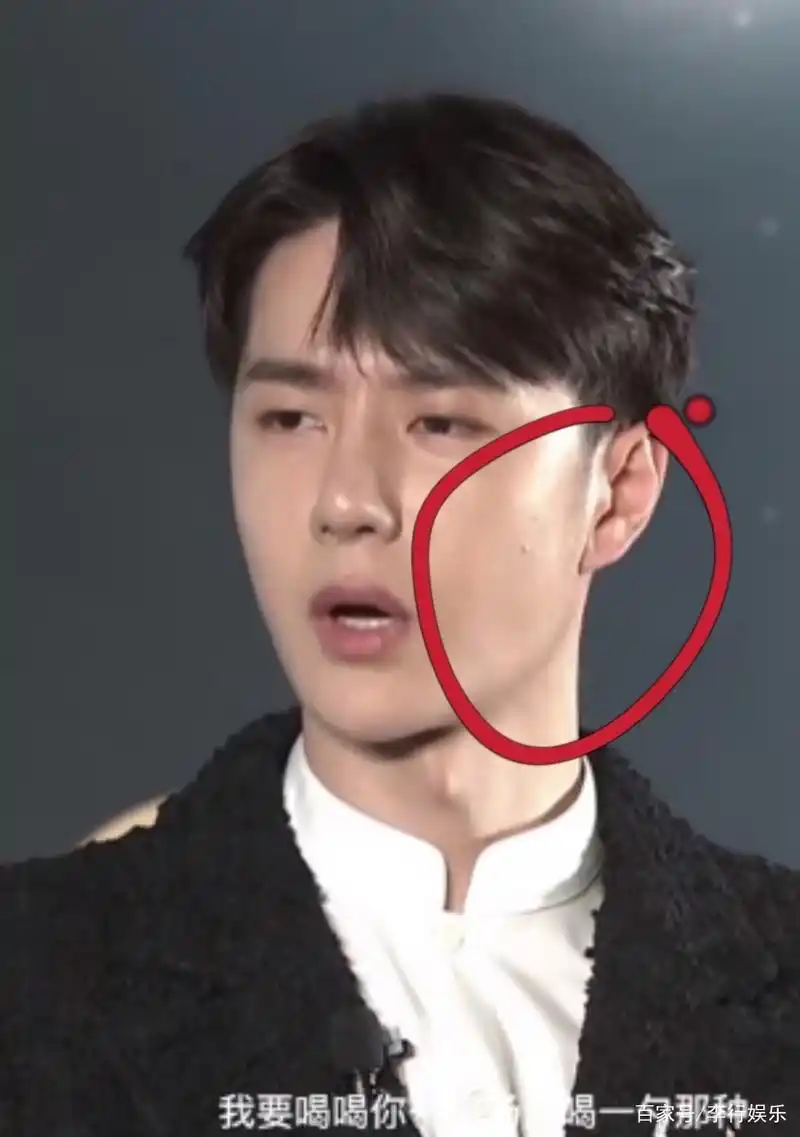 《风起洛阳》发布会宋轶缺席!王一博脸上"起痘",身体疑似不适