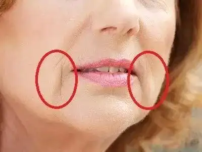 比发腮更可怕的是羊腮