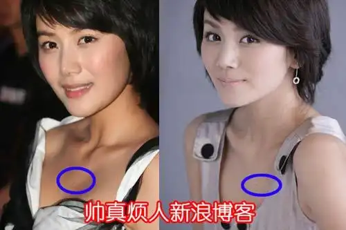 娱乐圈"胸有大痣"的十大美女明星(组图)