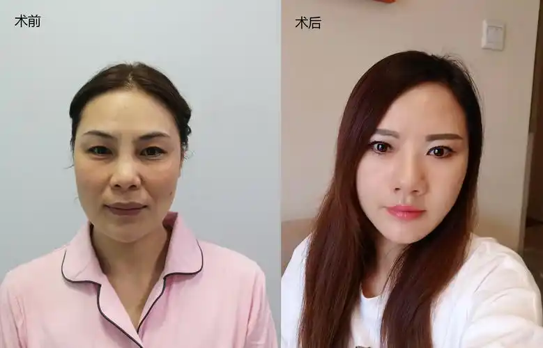 紧致肌肤:为什么皮肤会不紧致?不妨试试这几种紧致肌肤的方法!