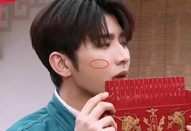 蔡徐坤皮肤怎么样当镜头拉近看到真实颜值后伤疤痘印太明显