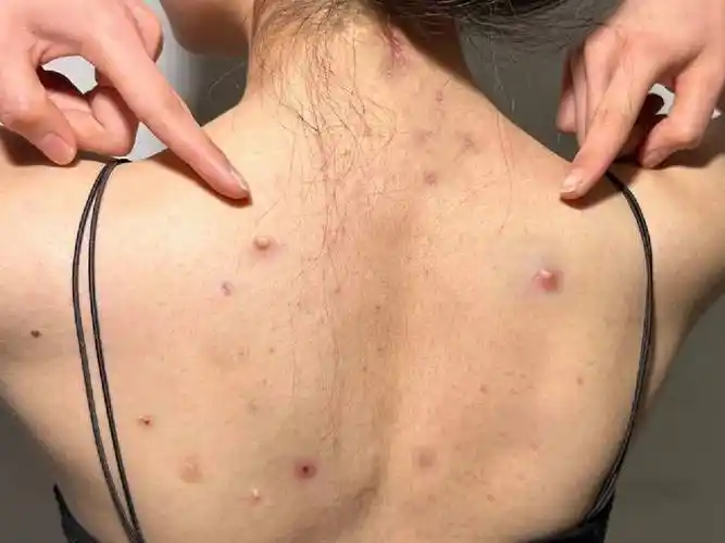 粗糙后背真能洗出牛奶肌!过来人的建议真牛