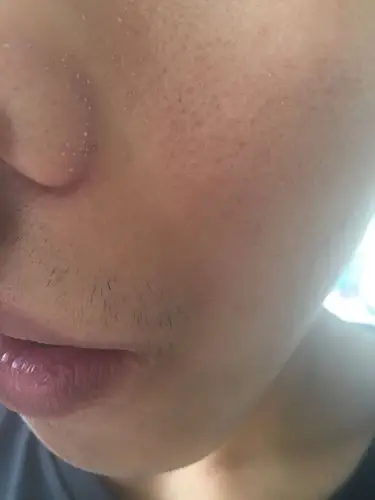 我的皮肤是否是角质层太薄的类型,楼主觉得自己是敏感肌肤,以前都是