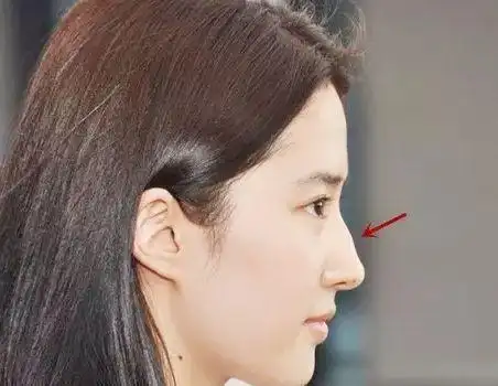 驼峰鼻好不好面相女