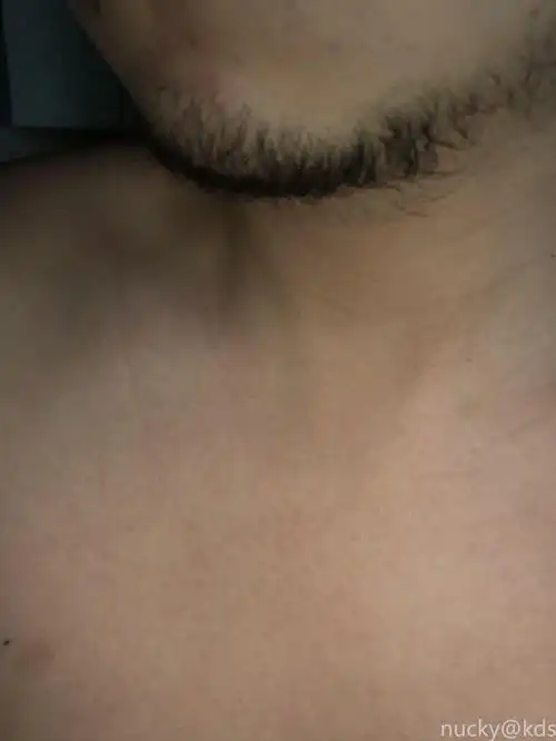 胡子稀少,有何良策