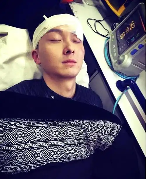 王浩信头上包扎着伤口