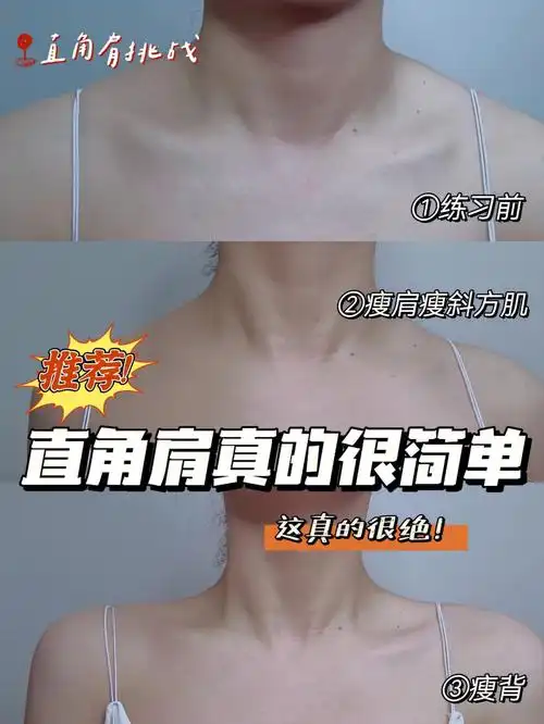 直角肩  #改善圆肩驼背   #消除斜方肌  #笔记灵感